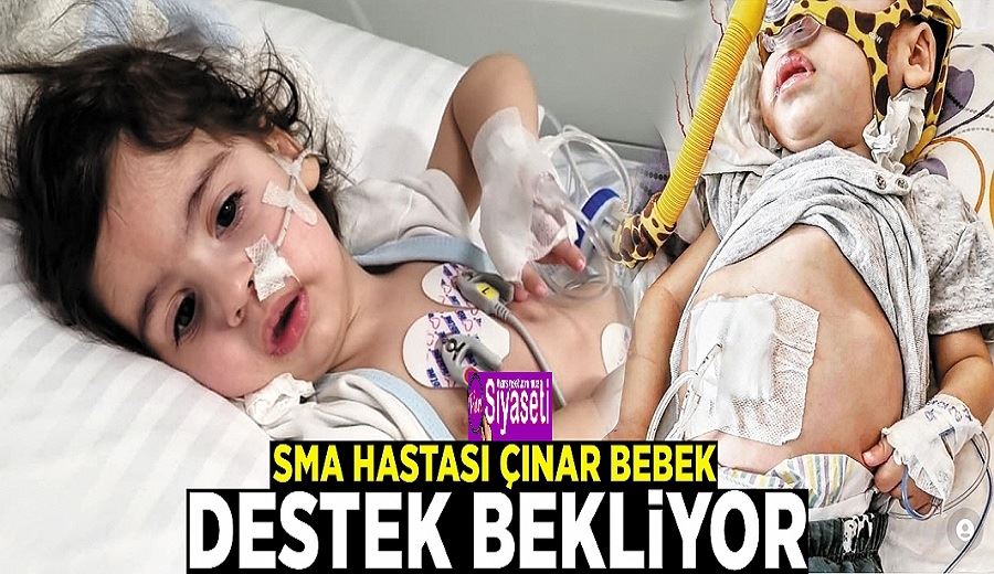 SMA hastası Çınar bebek, destek bekliyor